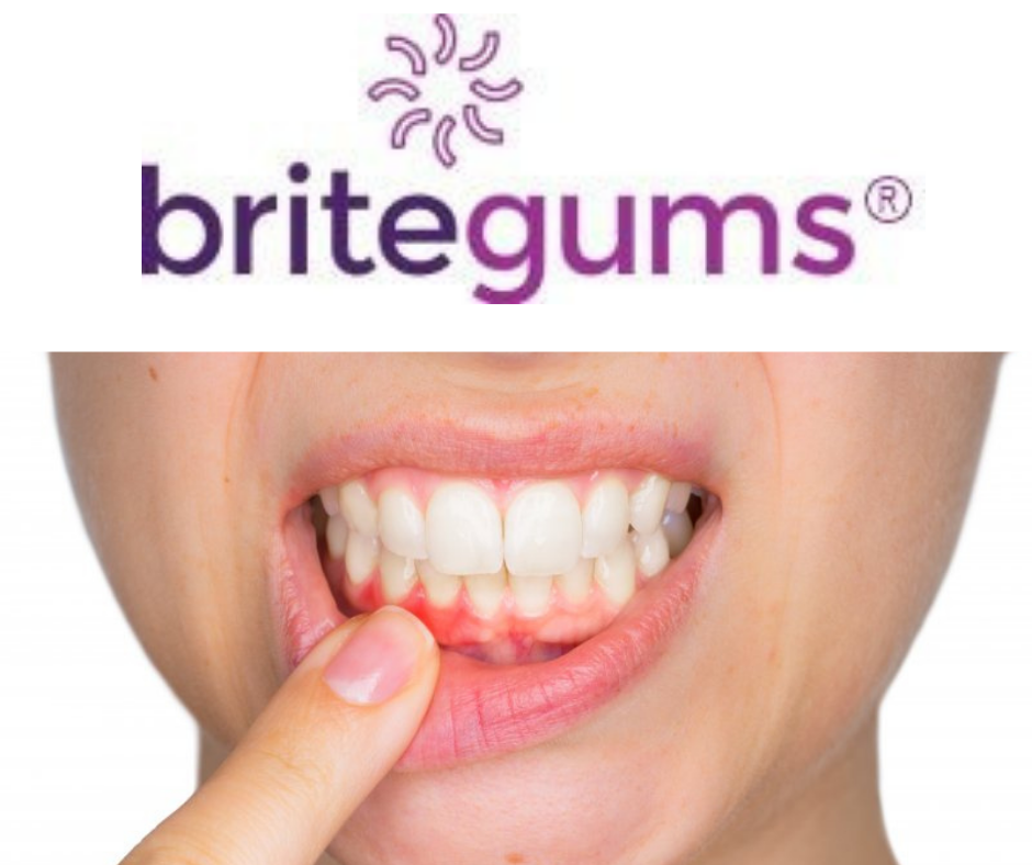 What Causes Black Gums  / Dark Gums?