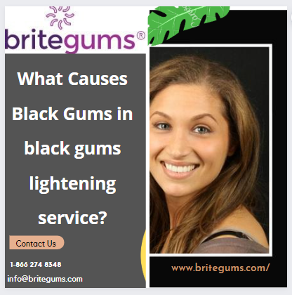 What Causes Black Gums in black gums lightening service?