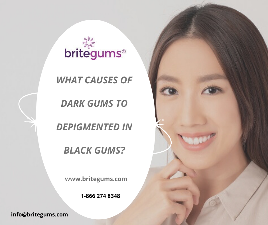 WHAT CAUSES OF DARK GUMS DEPIGMENTED IN BLACK GUMS?