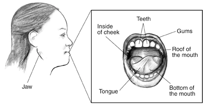 How Oral Physiological Pigmentation is used to make the gums shiny and beautiful in the gums lighteninig?