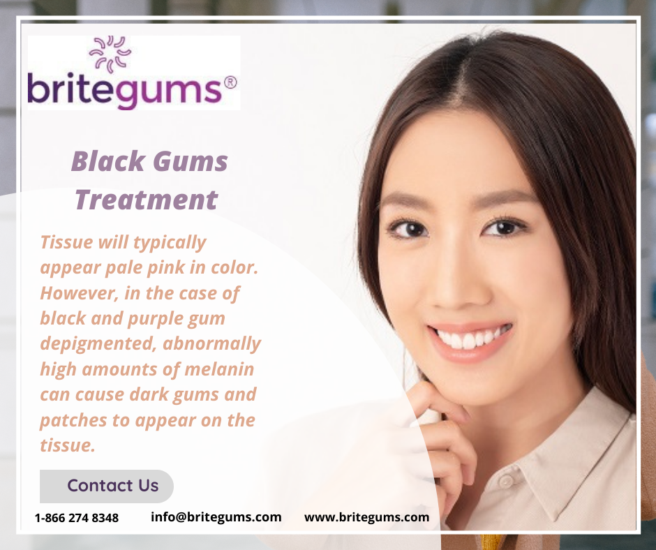    How do gums Hyperpigmentation Disorders in Characteristics and Treatments of Selected gums?