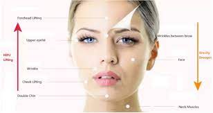 Anti Wrinkle Treatment - Important Tips About Surgery As a Treatment Option