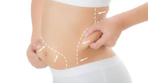 Comparing Body Contouring Options For Bikini Season