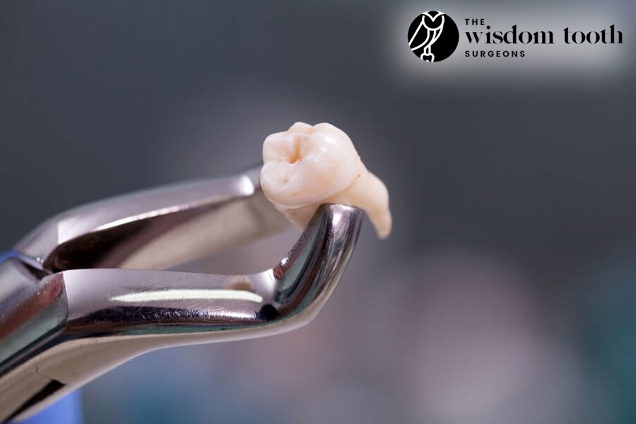 Interesting Facts About Wisdom Teeth