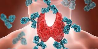Silent Thyroiditis Market Rising Trends, Demands and Business Outlook 2020-2028