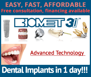Get Pretty Smile through Dental Implants