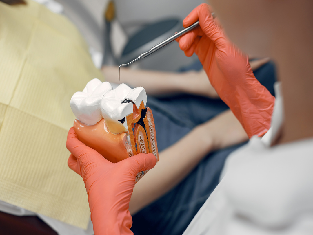 Unraveling the Truth About Root Canals: A Comprehensive Guide