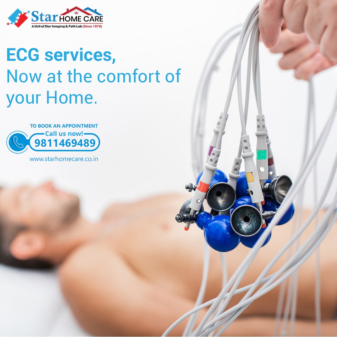 ECG Test at Home Near Me? Trust Star Home Care