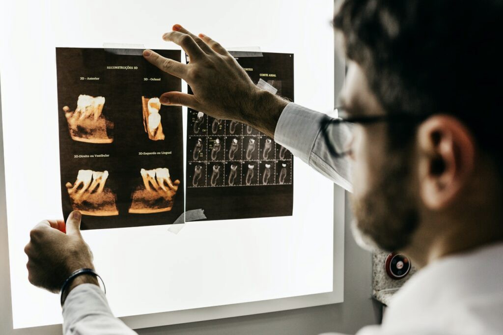 Laser root canal treatment