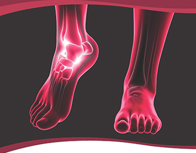 Foot and Ankle Allograft Market Size, Share, Regional Overview and Global Forecast to 2028