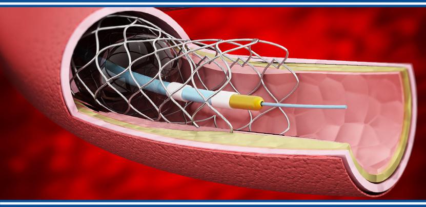 Interventional Cardiology and Peripheral Vascular Devices Market Size, Status, Growth | Industry Analysis Report 2022-2028