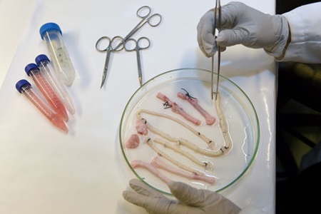 Global Synthetic Artificial Blood Vessels Market 2022: COVID-19 Impact Analysis and Industry Forecast Report, 2028