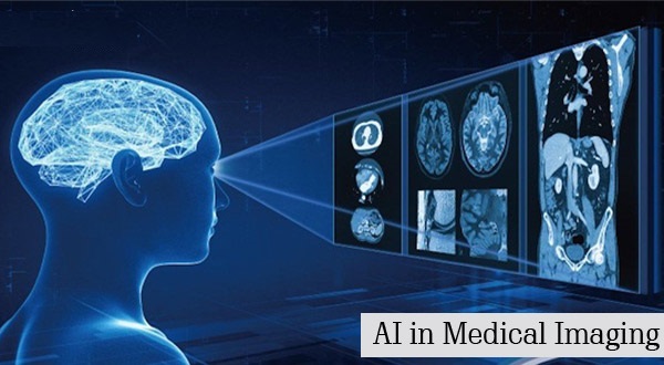 Artificial Intelligence in Medical Imaging Market 2022 Size, Growth Factors & Forecast Report to 2028