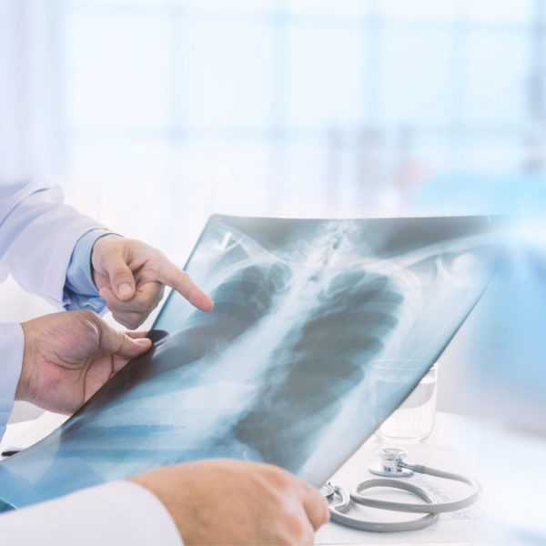 Tips On Dealing With Pulmonary Disease
