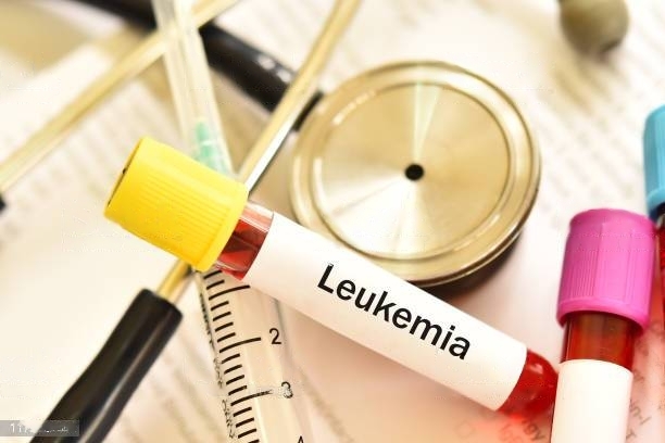 Understanding Lymphoma: Symptoms, Risk Factors, and Treatment Options