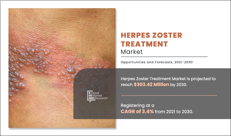 Herpes Zoster Treatment Market Key Trends, Growth Analysis and Industry Forecast- 2021-2032