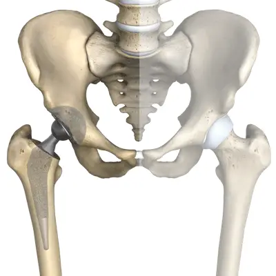 Dr Chirag Patel | About Hip Joint Overview | Mumbai | Surat