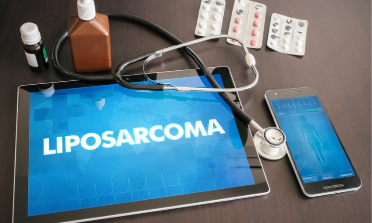 Liposarcoma: What You Need To Know | Dr. Haytham El Salhat