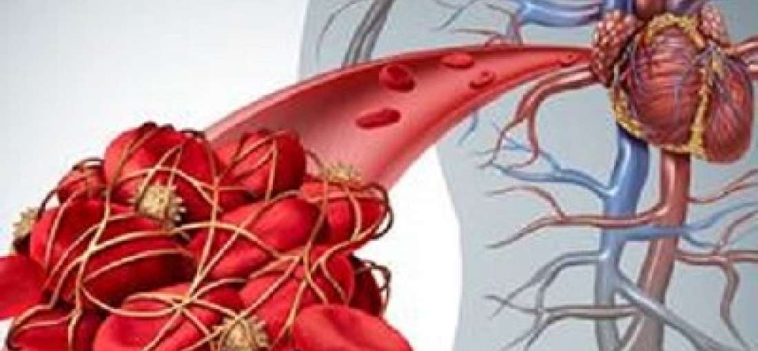 Platelet Aggregation Devices Market Development Analysis 2022 to 2030