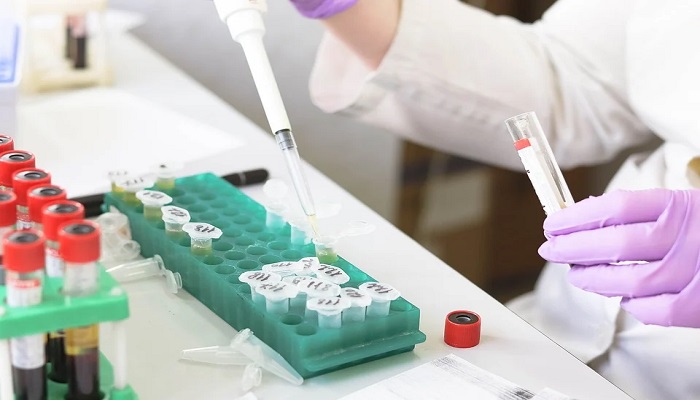 Bioanalytical Testing Services Market 2022 | Scope of Current and Future Industry 2030