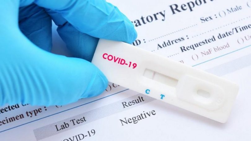 COVID-19 Diagnostics Market to Discern Magnified Growth During 2022 to 2030