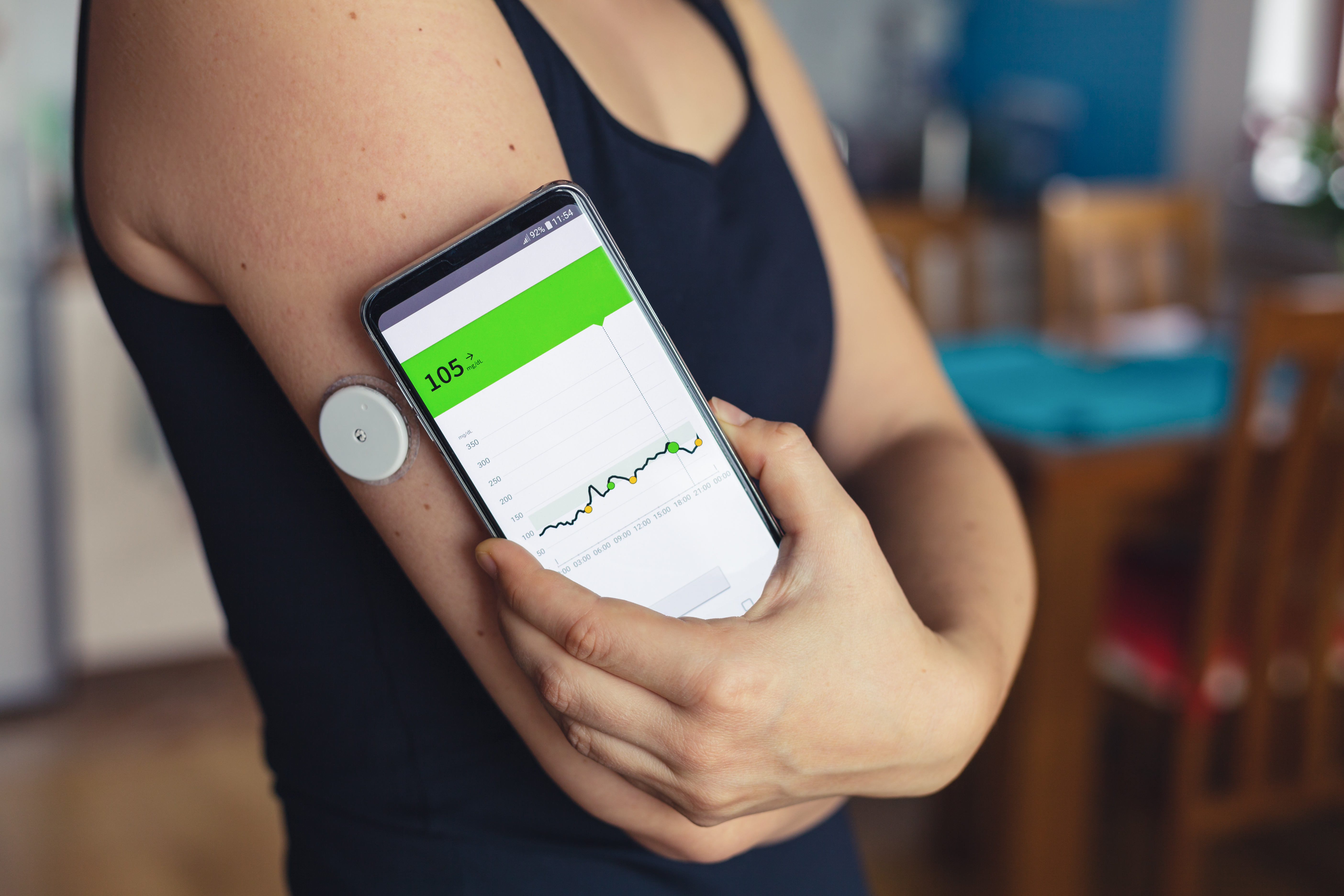 Continuous Glucose Monitoring Market Penetration, Development & Innovation, Market Diversification Analysis Report to 2023-2032
