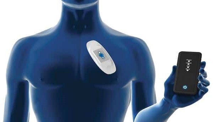 Mobile Cardiac Telemetry Systems Market Business 2022, Industry Trends, Supply Chain Analysis, Porter's Five Force Analysis and Forecast 2027