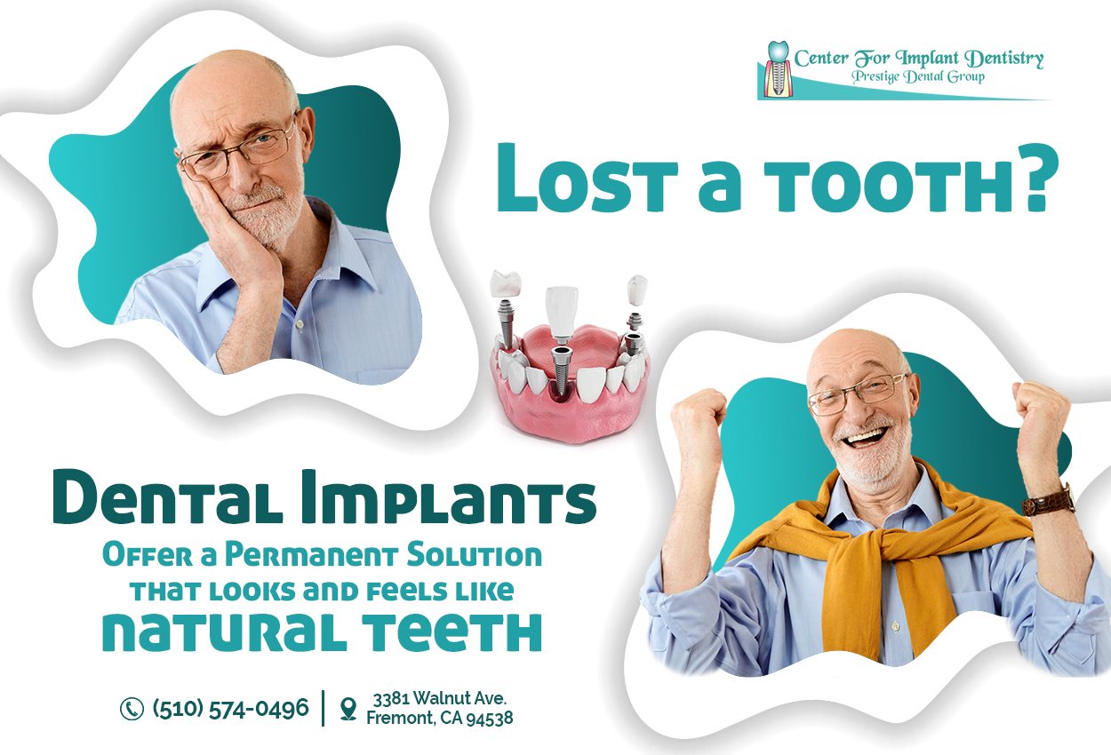 Dental Implants in Dentistry | Center for Implant Dentistry