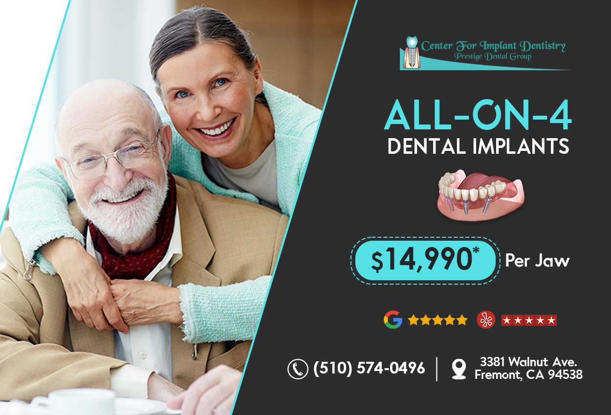 All on Four Bay Area | Center for Implant Dentistry