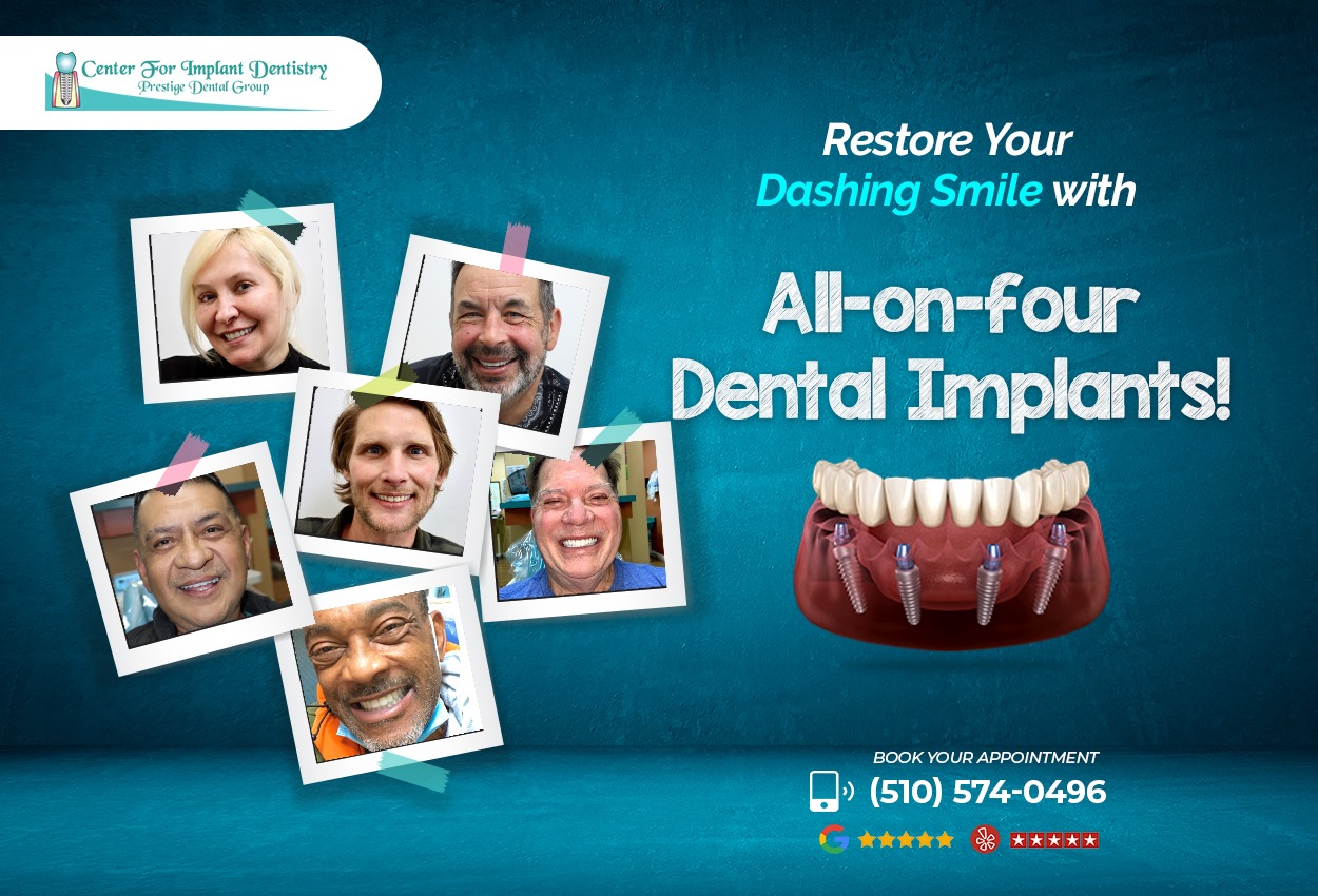 All on Four Implants Near Me | Center for Implant Dentistry