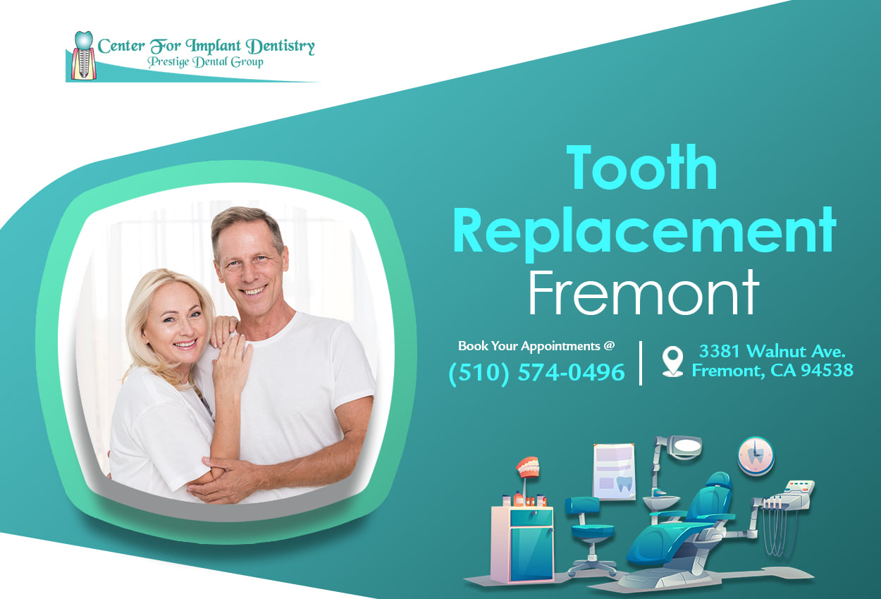 Tooth Replacement in Fremont | Center for Implant Dentistry