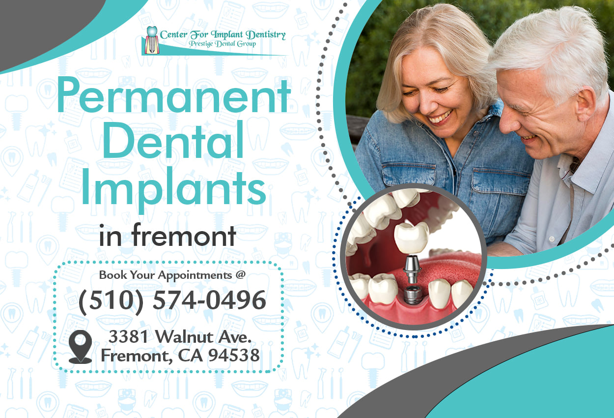 Permanent Dental Implants in Fremont | Center for Implant Dentistry