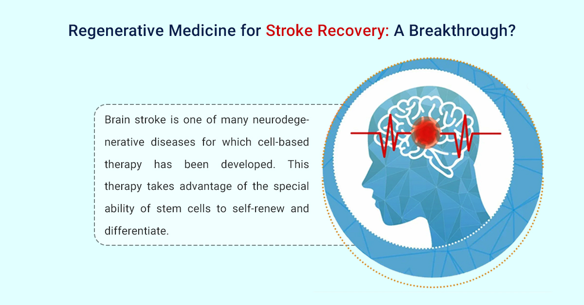 Regenerative Medicine for Stroke Recovery: A Breakthrough?