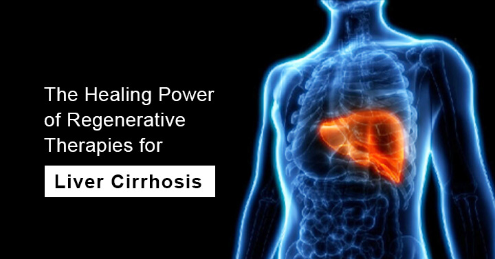 The Healing Power of Regenerative Therapies for Liver Cirrhosis