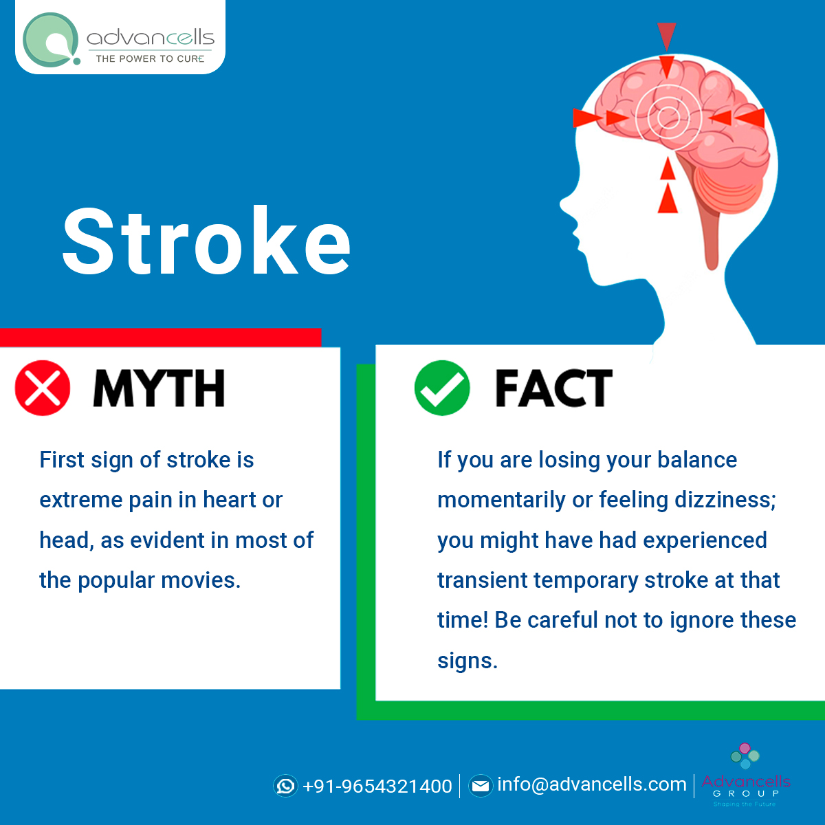 How Does Stress Shift Brain Processes?