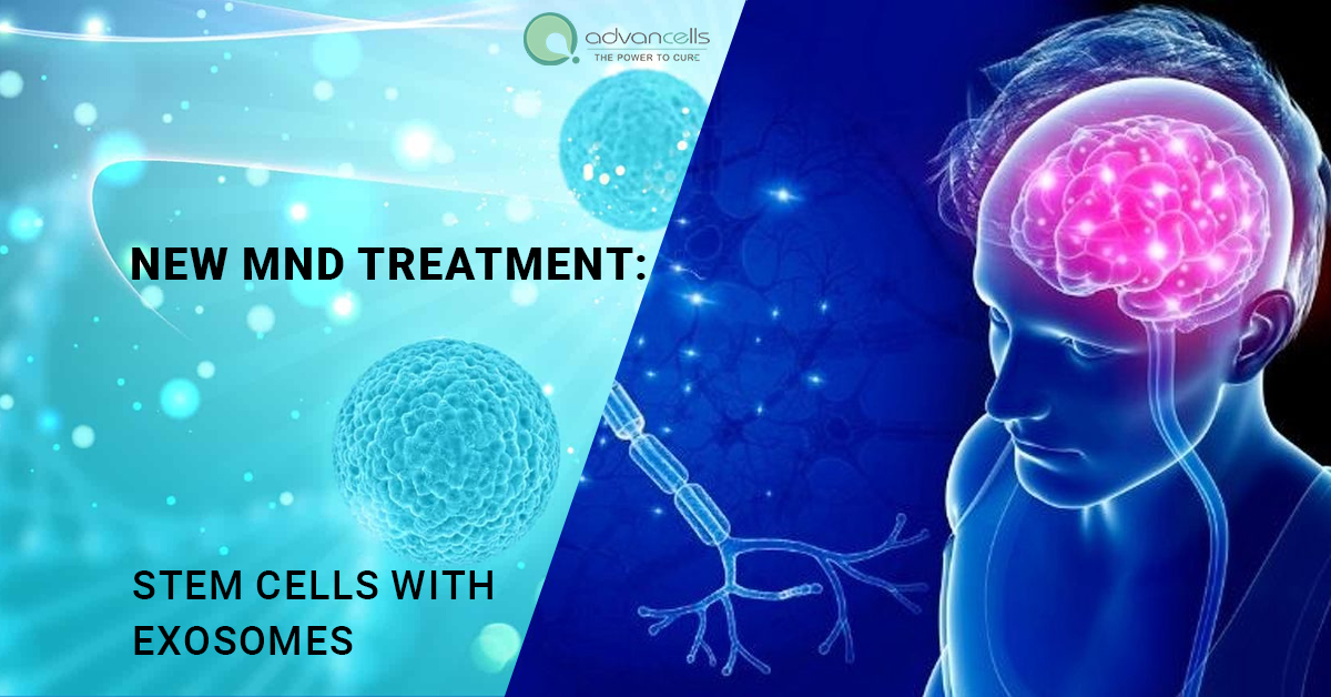 New MND Treatment: Stem Cells with Exosomes