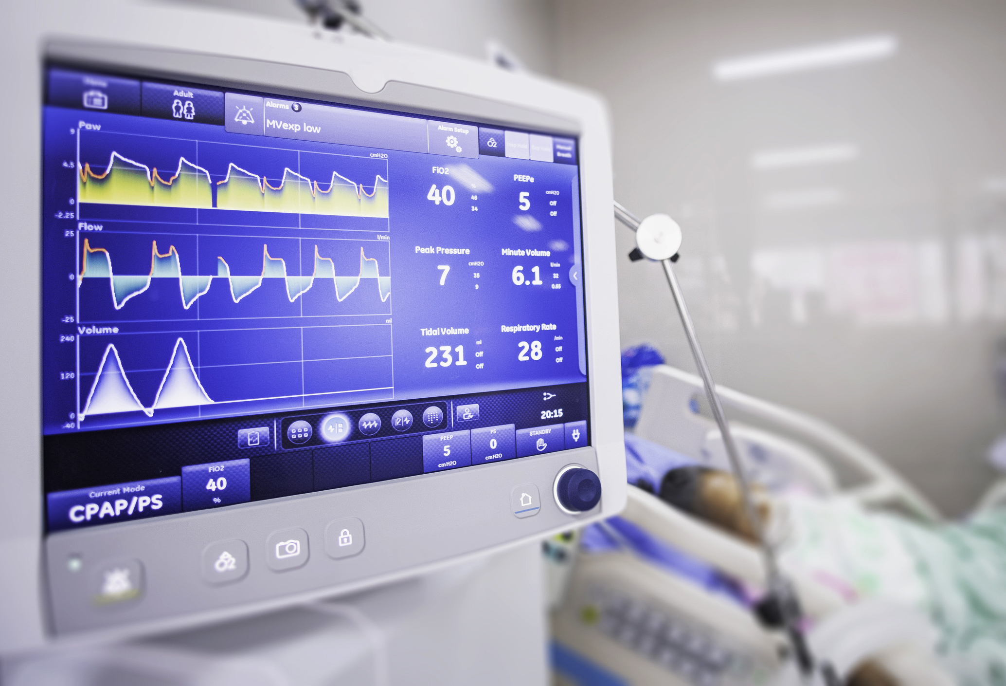 Ventilators Market Trends, Segmentation, Industry Growth, Forecast And Expansion 2022-2031
