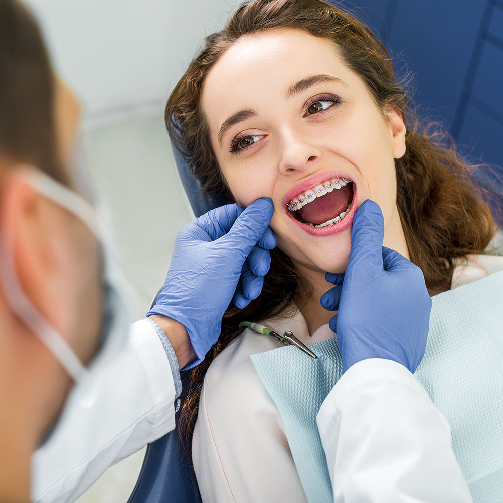 5 Important Things to Know Before Getting Braces