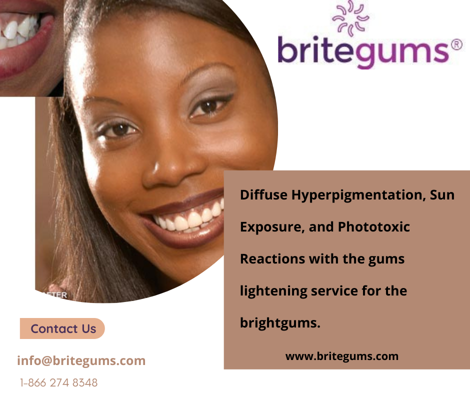 Diffuse Hyperpigmentation, Sun Exposure, and Phototoxic Reactions with the gums lightening service for the brightgums.