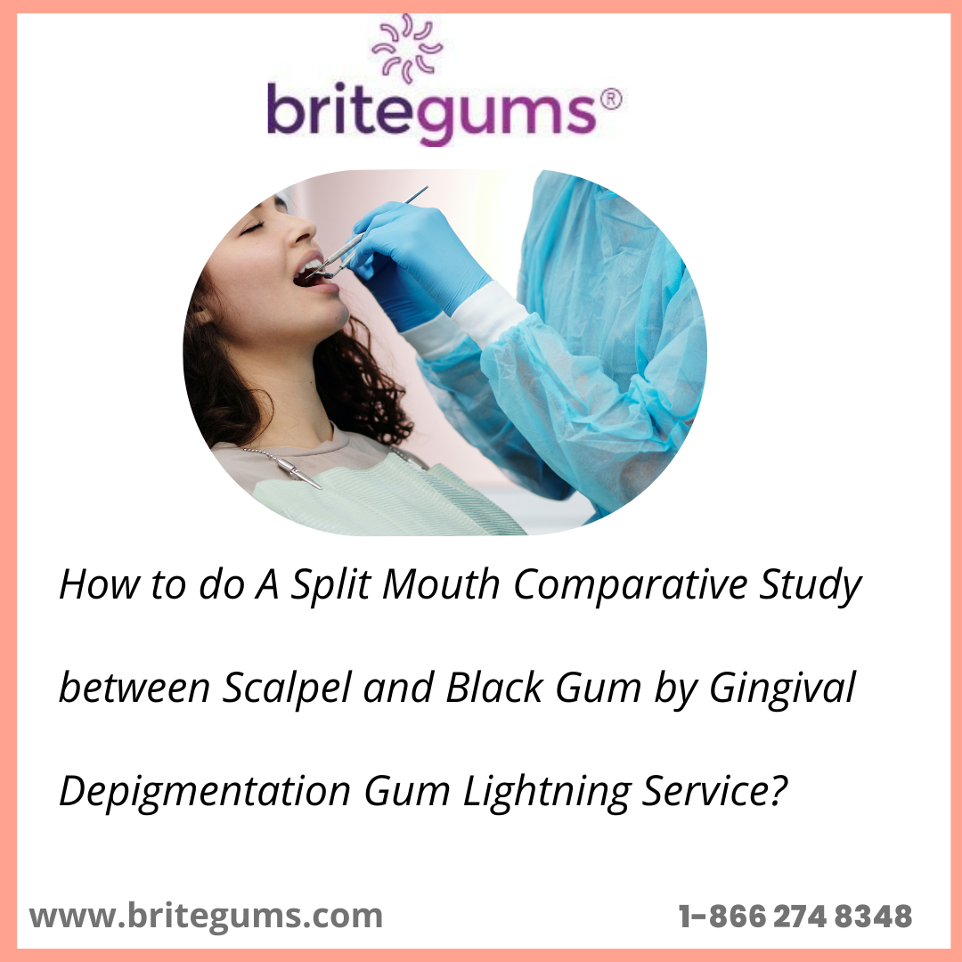   How to do A Split Mouth Comparative Study between Scalpel and Black Gum by Gingival Depigmentation Gum Lightning Service?