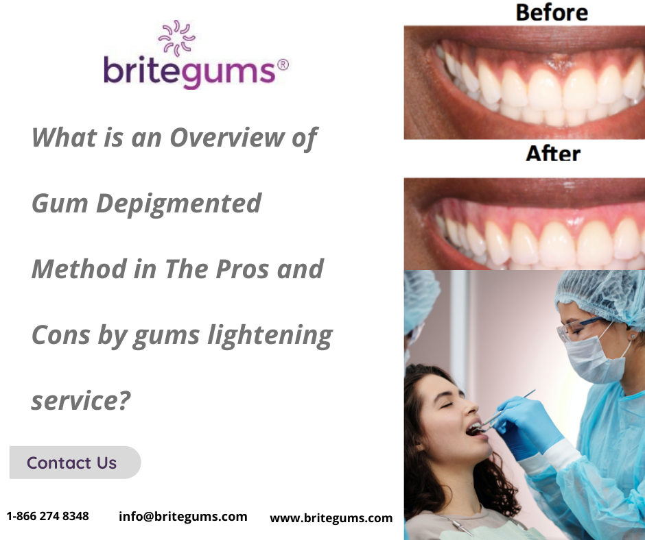 What is an Overview of Gum Depigmented Method in The Pros and Cons by gums lighteninig service? 