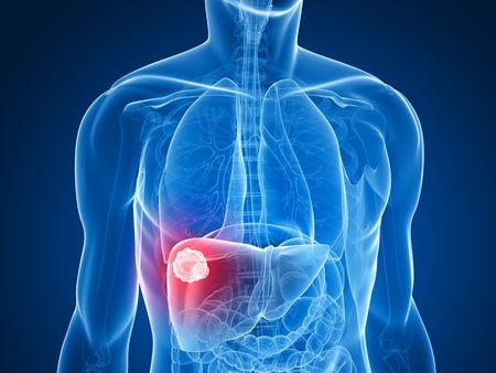 Tumor Ablation Market Trends, Share, Demand & Growth Analysis Report to 2030