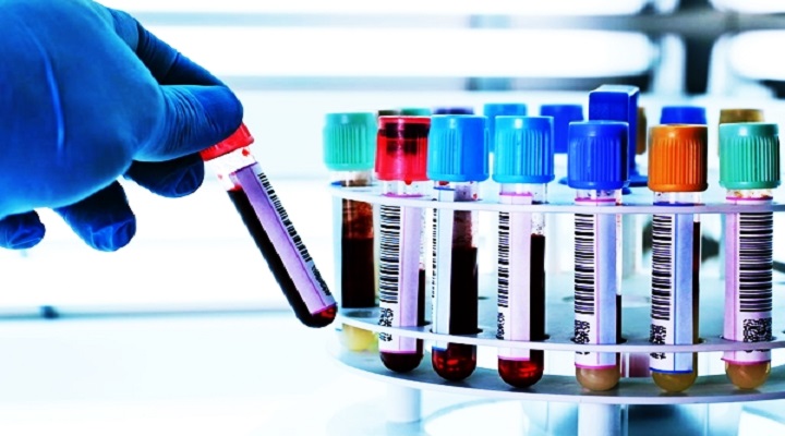 Clinical Laboratory Services Market Size, Dynamics & Forecast Report to 2030
