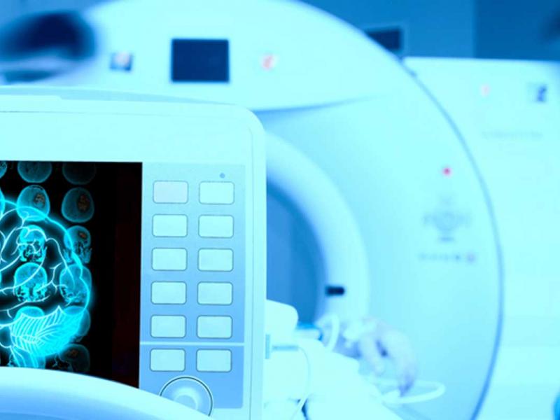 Gamma Knife Market Trends, Share, Demand & Growth Analysis Report to 2030