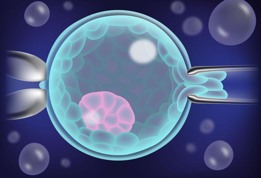 Preimplantation Genetic Testing Market Key Players, Dynamics & Latest Trades Report to 2030