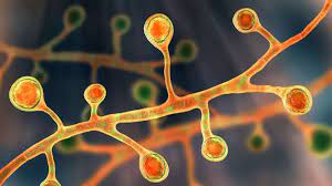 Global Blastomycosis Market Share, Latest Trades and Growth Analysis Report Till 2030
