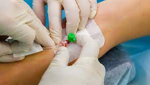 Vascular Access Device Market 2022 Growth, Share & Forecast Report to 2028