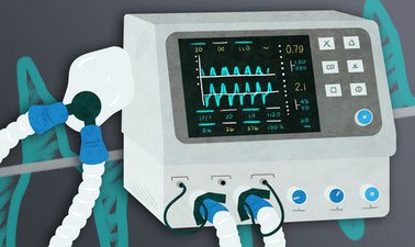 Mechanical Ventilators Market 2022 Top key Players and Analysis Report Till 2028