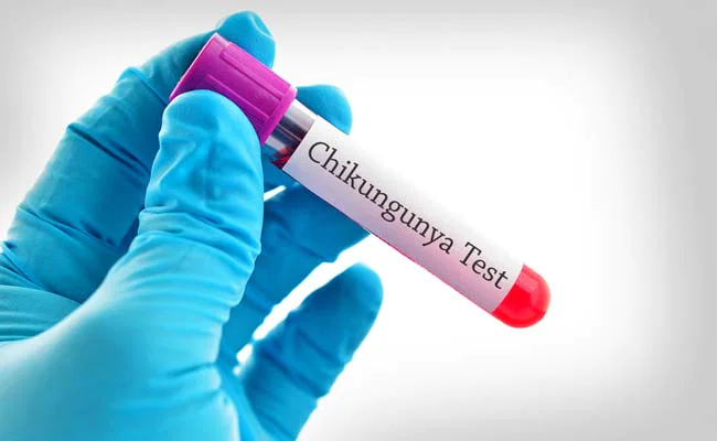 Chikungunya Diagnosis Market share | Industry Analysis By Top Key Players, Demand, Growth factors to 2028