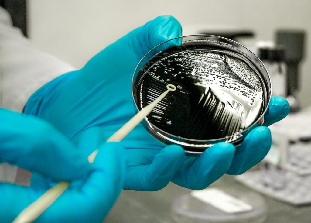 Legionella Testing Market Insight | Outlook | Growth Analysis Report 2030